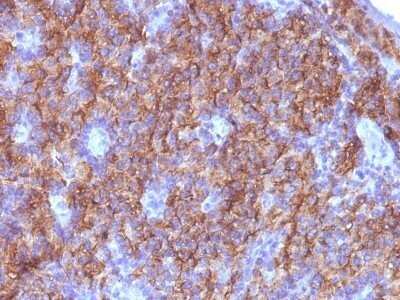 Immunohistochemistry-Paraffin: Chromogranin A Antibody (CGA/413 + CHGA/777 + CHGA/798) - IHC-Prediluted [NBP2-48063]