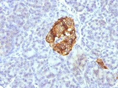 Immunohistochemistry-Paraffin: Chromogranin A Antibody (CGA/413 + CHGA/777 + CHGA/798) [NBP2-44764]