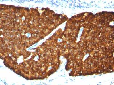 Immunohistochemistry-Paraffin: Chromogranin A Antibody (CGA/413) - Azide and BSA Free [NBP2-47850]