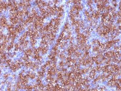 Immunohistochemistry-Paraffin: Chromogranin A Antibody (CGA/413) - Azide and BSA Free [NBP2-47850]