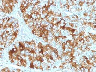 Immunohistochemistry-Paraffin: Chromogranin A Antibody (CGA/413) - Azide and BSA Free [NBP2-47850]