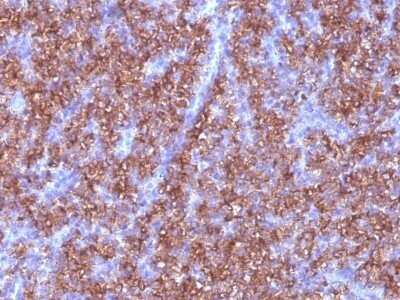 Immunohistochemistry-Paraffin: Chromogranin A Antibody (CGA/413) - IHC-Prediluted [NBP2-48081]