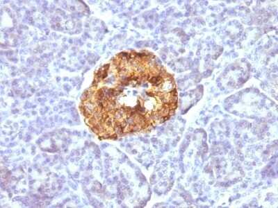 Immunohistochemistry-Paraffin: Chromogranin A Antibody (CGA/413) [NBP2-44776]