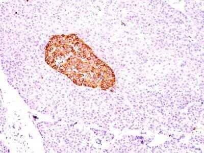 Immunohistochemistry-Paraffin: Chromogranin A Antibody (CGA/414) - Azide and BSA Free [NBP2-33198]