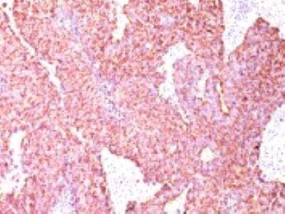 Immunohistochemistry-Paraffin: Chromogranin A Antibody (CGA/414) [NBP2-29428]