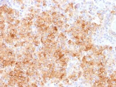Immunohistochemistry-Paraffin: Chromogranin A Antibody (CHGA/1731R) - Azide and BSA Free [NBP2-54316]