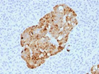 Immunohistochemistry-Paraffin: Chromogranin A Antibody (CHGA/1731R) [NBP2-53139]