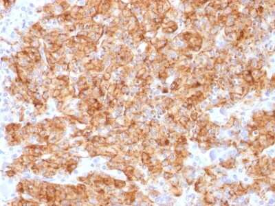 Immunohistochemistry-Paraffin: Chromogranin A Antibody (CHGA/1773R) - Azide and BSA Free [NBP2-54382]