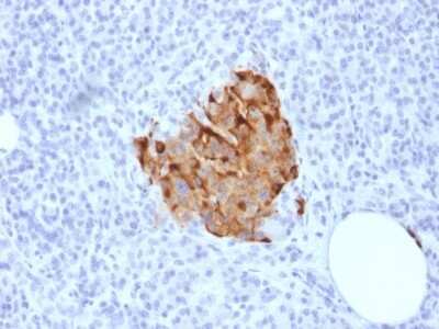 Immunohistochemistry-Paraffin: Chromogranin A Antibody (CHGA/1773R) [NBP2-53140]