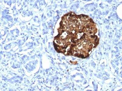 Immunohistochemistry-Paraffin: Chromogranin A Antibody (CHGA/1815R) - Azide and BSA Free [NBP2-54363]