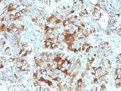 Immunohistochemistry-Paraffin: Chromogranin A Antibody (CHGA/765) - Azide and BSA Free [NBP2-47847]