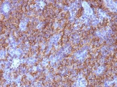 Immunohistochemistry-Paraffin: Chromogranin A Antibody (CHGA/765) - Azide and BSA Free [NBP2-47847]