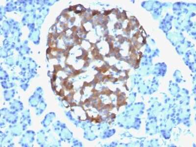 Immunohistochemistry-Paraffin: Chromogranin A Antibody (CHGA/765) [NBP2-44773]