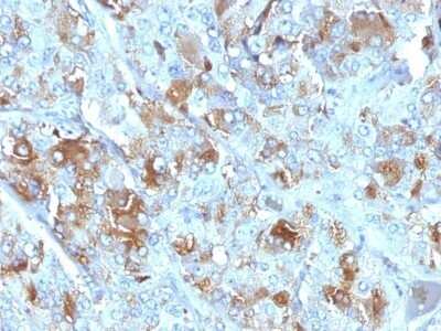 Immunohistochemistry-Paraffin: Chromogranin A Antibody (CHGA/777) - Azide and BSA Free [NBP2-47848]