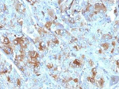 Immunohistochemistry-Paraffin: Chromogranin A Antibody (CHGA/777) [NBP2-44774]