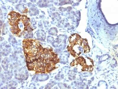 Immunohistochemistry-Paraffin: Chromogranin A Antibody (CHGA/777) [NBP2-44774]