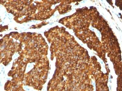 Immunohistochemistry-Paraffin: Chromogranin A Antibody (CHGA/777) [NBP2-44774]