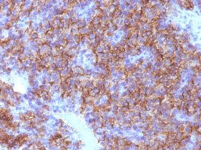 Immunohistochemistry-Paraffin: Chromogranin A Antibody (CHGA/798) - Azide and BSA Free [NBP2-47849]
