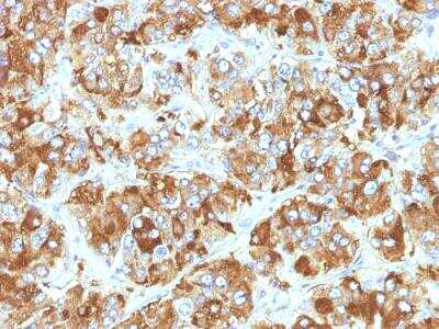 Immunohistochemistry-Paraffin: Chromogranin A Antibody (CHGA/798) - Azide and BSA Free [NBP2-47849]