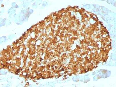 Immunohistochemistry-Paraffin: Chromogranin A Antibody (CHGA/798) - Azide and BSA Free [NBP2-47849]