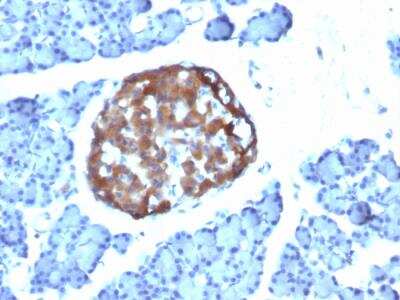 Immunohistochemistry-Paraffin: Chromogranin A Antibody (CHGA/798) - Azide and BSA Free [NBP2-47849]