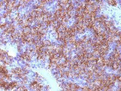 Immunohistochemistry-Paraffin: Chromogranin A Antibody (CHGA/798) - IHC-Prediluted [NBP2-48072]