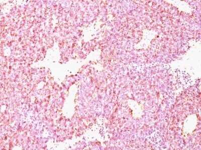 Immunohistochemistry-Paraffin: Chromogranin A Antibody (CHGA/798) - IHC-Prediluted [NBP2-48072]