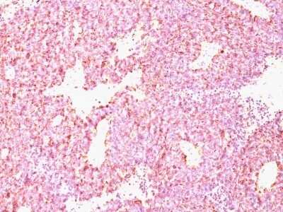 Immunohistochemistry-Paraffin: Chromogranin A Antibody (CHGA/798) [NBP2-44775]