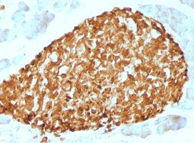 Immunohistochemistry-Paraffin: Chromogranin A Antibody (CHGA/798) [NBP2-44775]