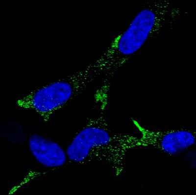 Immunocytochemistry/ Immunofluorescence: Chromogranin A Antibody (CL0166) [NBP2-52869]