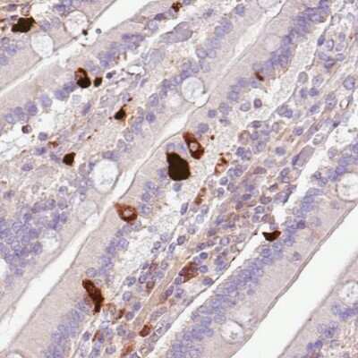 Immunohistochemistry-Paraffin: Chromogranin A Antibody (CL0166) [NBP2-52869]