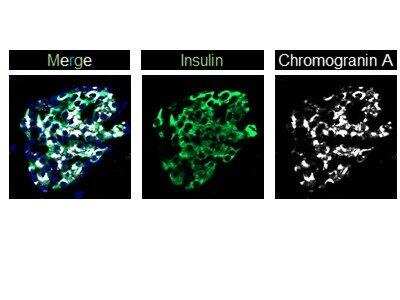 Immunocytochemistry/ Immunofluorescence: Chromogranin A Antibody - BSA Free [NB120-15160]