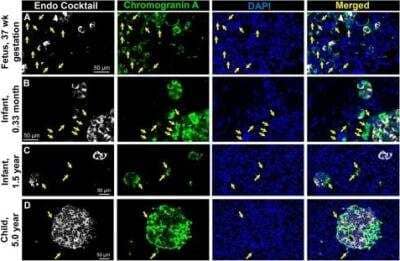 Immunocytochemistry/ Immunofluorescence: Chromogranin A Antibody - BSA Free [NB120-15160]