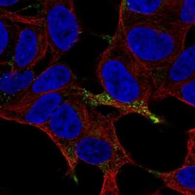 Immunocytochemistry/ Immunofluorescence: Chromogranin A Antibody [NBP1-86056]