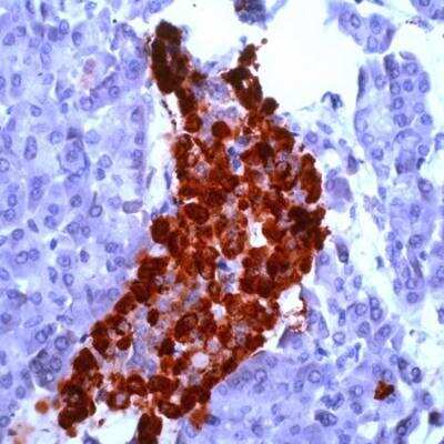 Immunohistochemistry: Chromogranin A Antibody - BSA Free [NB120-15160]