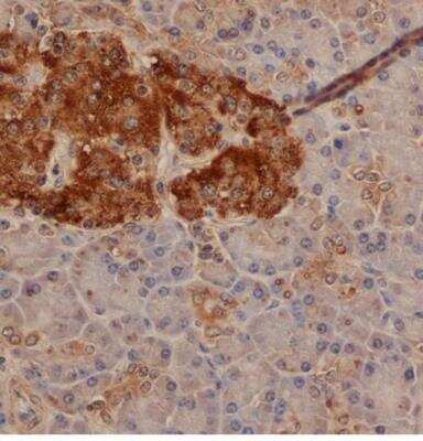 Immunohistochemistry-Paraffin: Chromogranin A Antibody - BSA Free [NB100-62464]