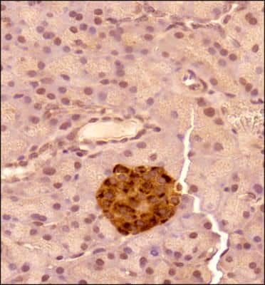 Immunohistochemistry-Paraffin: Chromogranin A Antibody - BSA Free [NB120-15160]