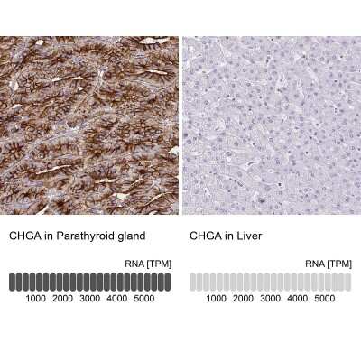 Immunohistochemistry-Paraffin: Chromogranin A Antibody [NBP1-86056]