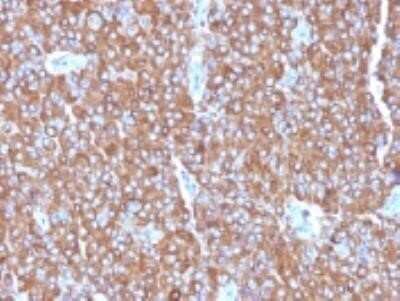 Immunohistochemistry-Paraffin: Chromogranin A Antibody (LK2H10 + PHE5 + CGA/414) - Azide and BSA Free [NBP2-34674]