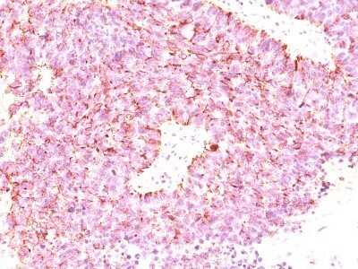 Immunohistochemistry-Paraffin: Chromogranin A Antibody (LK2H10 + PHE5 + CGA/414) - Azide and BSA Free [NBP2-34674]