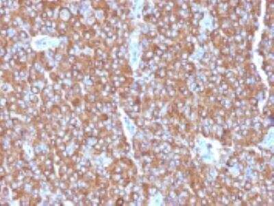 Immunohistochemistry-Paraffin: Chromogranin A Antibody (LK2H10 + PHE5 + CGA/414) [NBP2-34240]