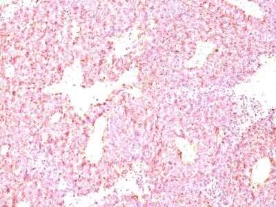 Immunohistochemistry-Paraffin: Chromogranin A Antibody (LK2H10 + PHE5) - Azide and BSA Free [NBP2-34673]