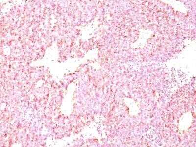 Immunohistochemistry-Paraffin: Chromogranin A Antibody (LK2H10 + PHE5) - IHC-Prediluted [NBP2-44771]