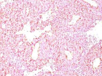 Immunohistochemistry-Paraffin: Chromogranin A Antibody (LK2H10 + PHE5) [NBP2-34239]