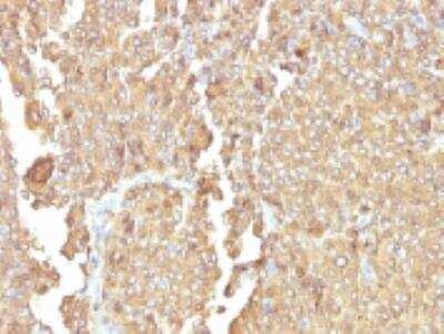 Immunohistochemistry-Paraffin: Chromogranin A Antibody (LK2H10 + PHE5) [NBP2-34239]