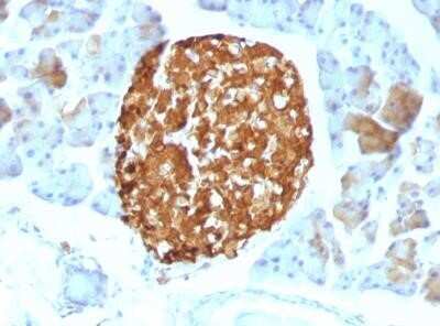 Immunohistochemistry-Paraffin: Chromogranin A Antibody (LK2H10) - Azide and BSA Free [NBP2-34672]