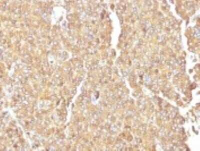 Immunohistochemistry-Paraffin: Chromogranin A Antibody (LK2H10) - Azide and BSA Free [NBP2-34672]