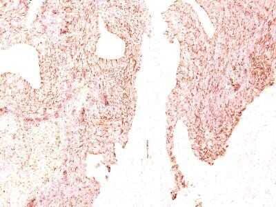 Immunohistochemistry-Paraffin: Chromogranin A Antibody (LK2H10) - Azide and BSA Free [NBP2-34672]