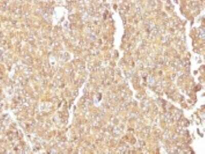 Immunohistochemistry-Paraffin: Chromogranin A Antibody (LK2H10) - IHC-Prediluted [NBP2-44767]