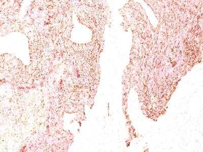 Immunohistochemistry-Paraffin: Chromogranin A Antibody (LK2H10) [NBP2-32956]
